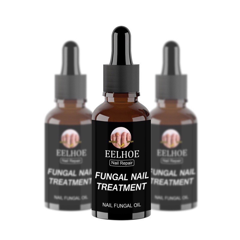 [Serum nấm móng] tinh chất thảo dược nấm móng tay chân nhập khẩu
