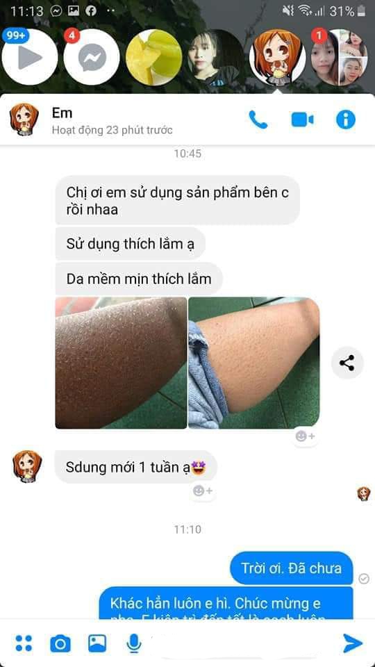 Combo lớn Tắm men bia + Kem Multi 16 Athena 30g