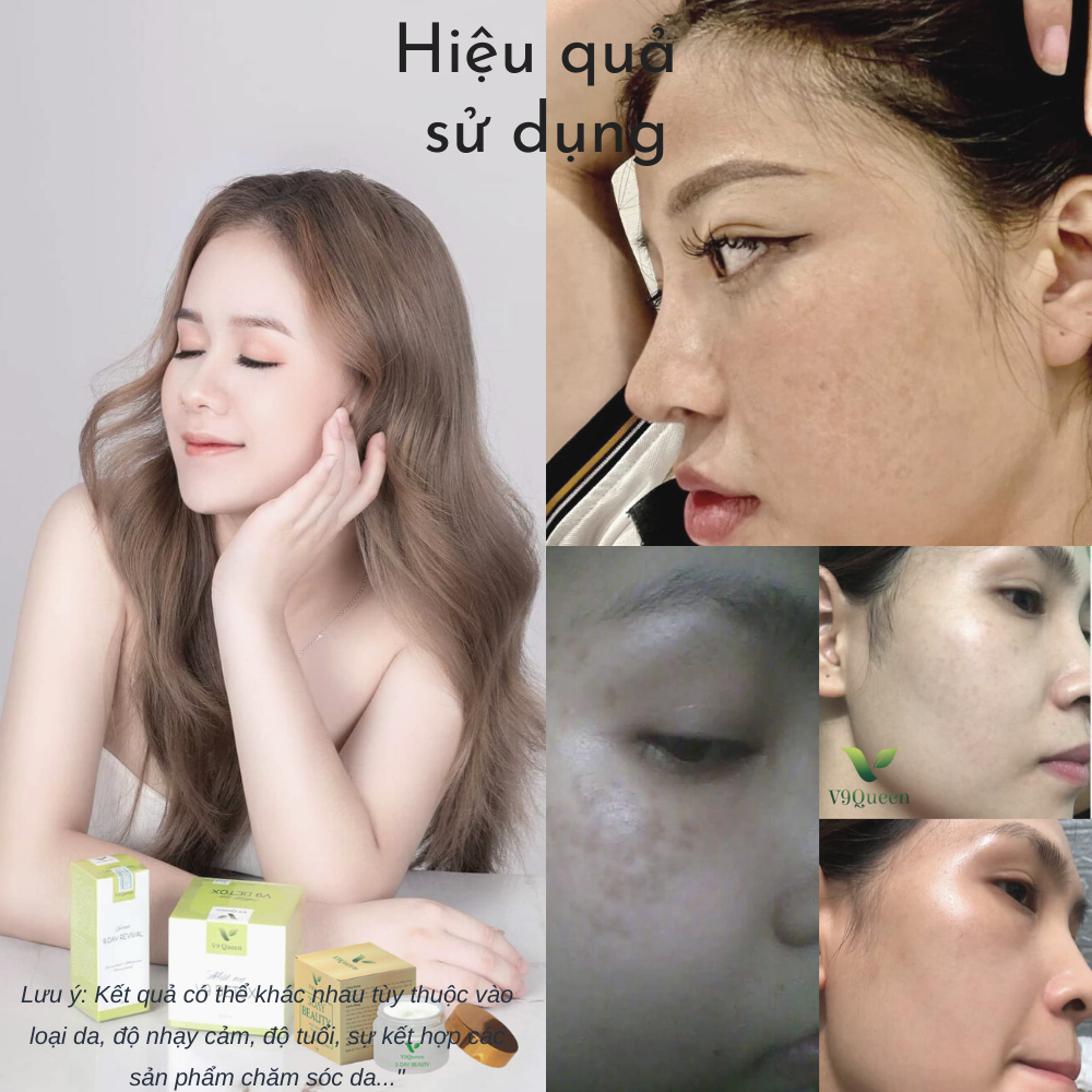 [COMBO] kem nám tàn nhang V9Queen, dưỡng da serum chuyên sâu, bộ chăm sóc da mặt V9 Detox 30ml, 9Day Revival 10ml, 3Day Beauty 10g