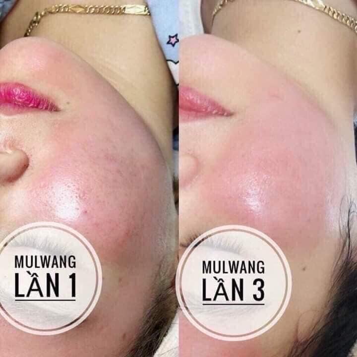 Tinh chất căng bóng Mulwang x5 Hàn Quốc