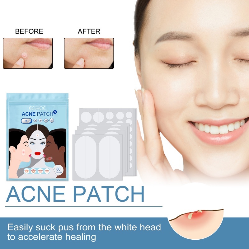 80Pcs Pimple Patch Makeup Invisible Hydrocolloid Comedo Patches