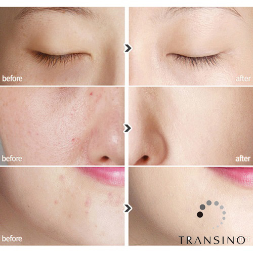 Transino trắng da  240 viên