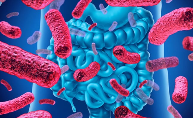 Probiotic - 32 Tỉ lợi khuẩn - Men tiêu hóa
