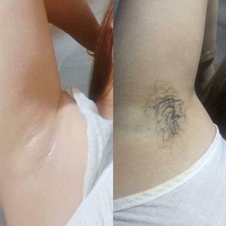 Kem tẩy lông Kone Thái Lan