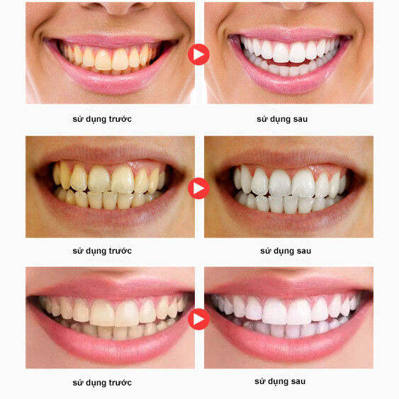 Bột đánh răng, làm sáng răng.Bột tẩy trắng răng chất làm trắng răng bảo vệ men răng,chăm sóc răng miệng, bột khử mùi hôi răng miệng hiệu quả cấp tốc，hơi thở thơm tho.