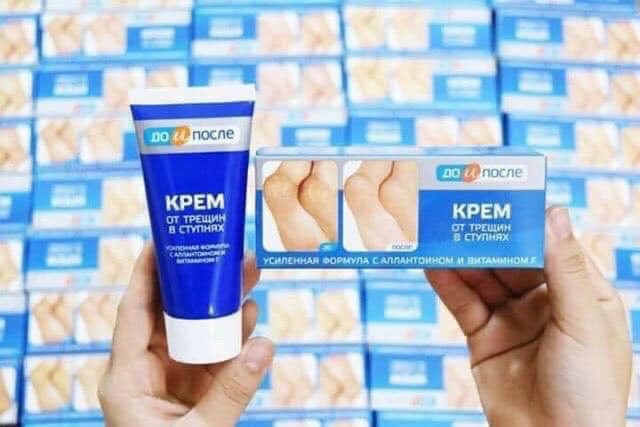 KEM TRỊ NỨT GÓT CHÂN KPEM APTEKA NGA - DATE 2025