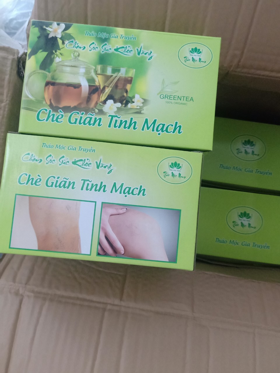 Chè giãn tĩnh mạch