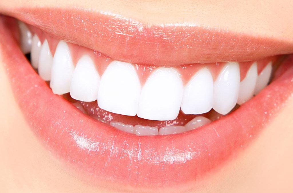 Kem Đánh Răng Colgate Total Advanced Whitening 181g - Mỹ