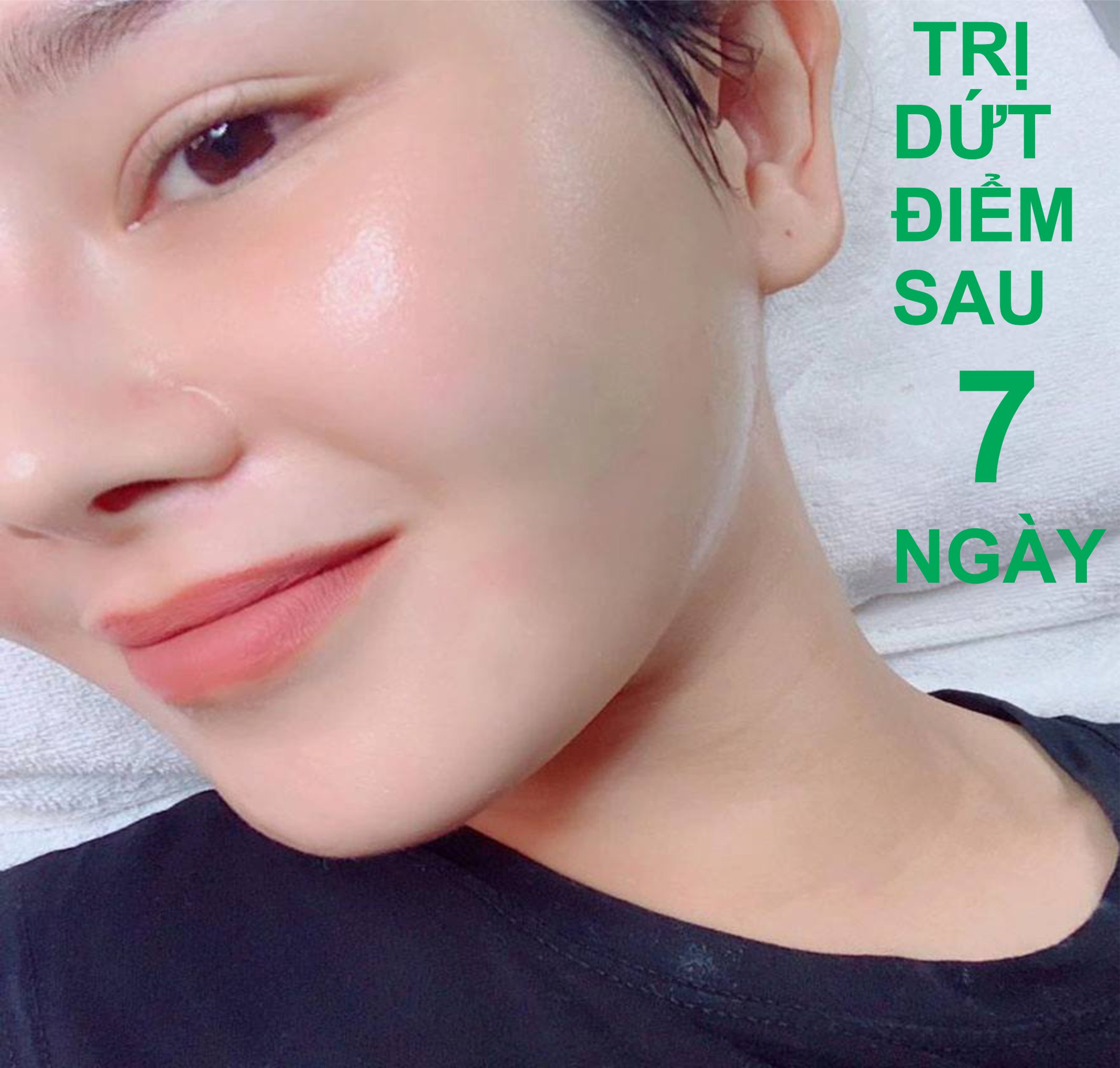Serum sạch mụn xóa thâm sẹo rổ nám tàn nhang EBeauty Viral