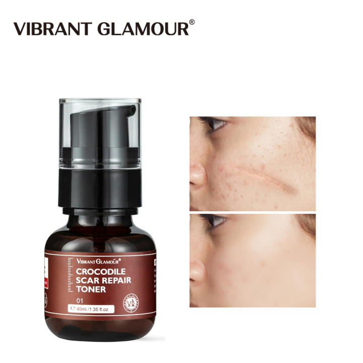 VIBRANT GLAMOUR Serum Làm Mờ Sẹo Rỗ Giảm Mụn Tâm Làm Mờ Sẹo Lâu Năm 30ml