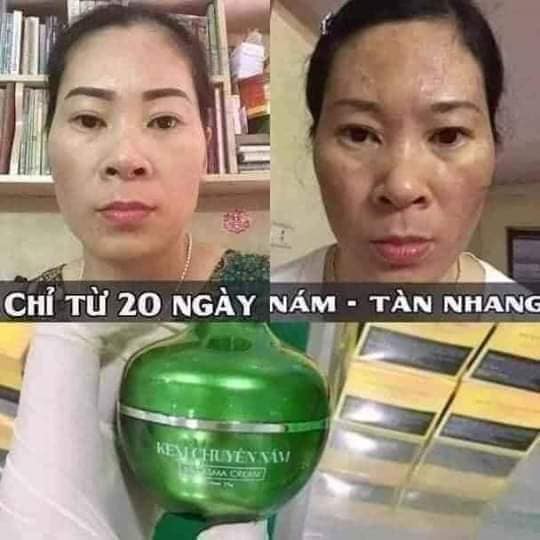 Kem nám Huỳnh Đỗ