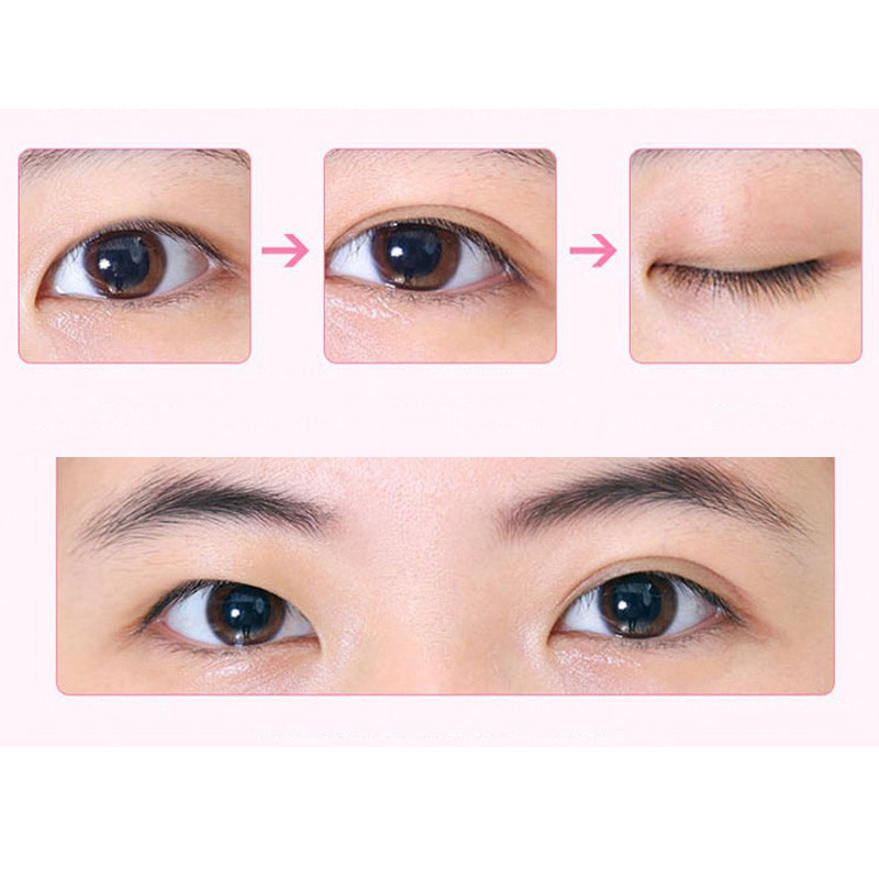 Miếng Dán Mí Vân Lưới Hộp 600 Cái