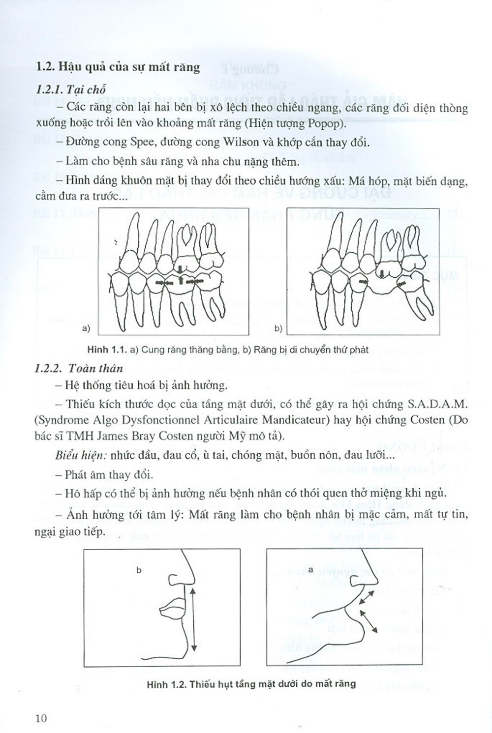 Phục Hình Răng Tháo Lắp (Dùng Cho Sinh Viên Răng Hàm Mặt)