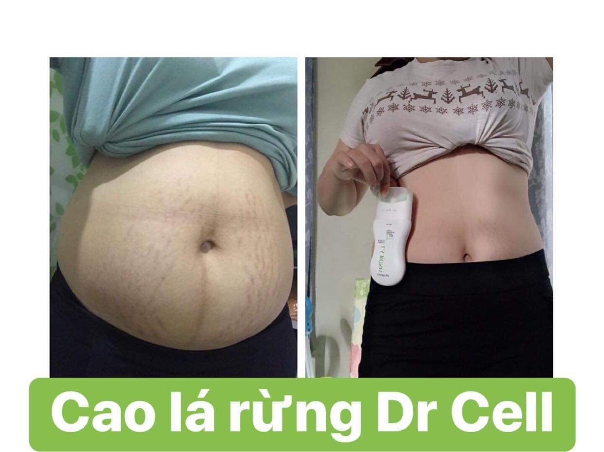 Cao Tan mỡ lá rừng