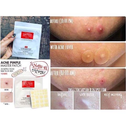 [HCM]Miếng Dán Xẹp Mụn Cấp Tốc Che Khuyết Điểm Cosrx Acne Pimple Master Patch (Gồm 24 miếng dán)
