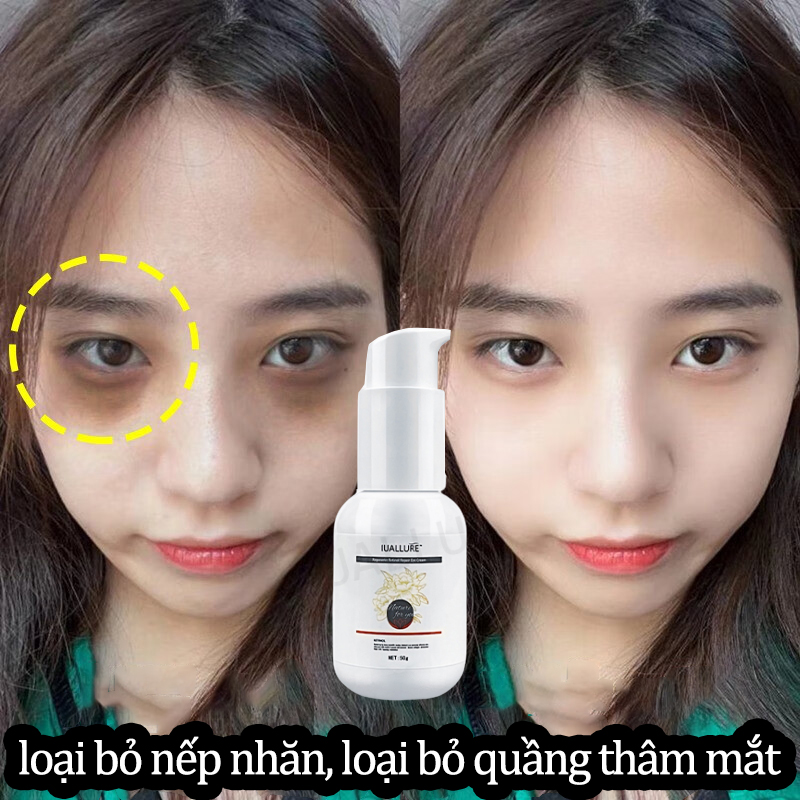 Kem dưỡng mắt,kem mắt retinol thâm quầng mắt Eye Chính Hãng Ngừa Lão Hóa Hỗ Trợ Giảm Quầng Thâm & Bọng Mắt Giảm Thâm Bọng Mắt Giảm Sắc Tố Melalin Sậm Da
