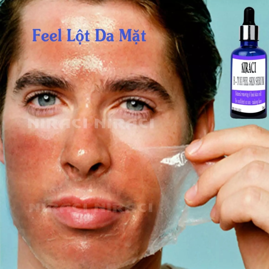 Feel Thay da Xóa Nám Niraci của Hàn Quốc