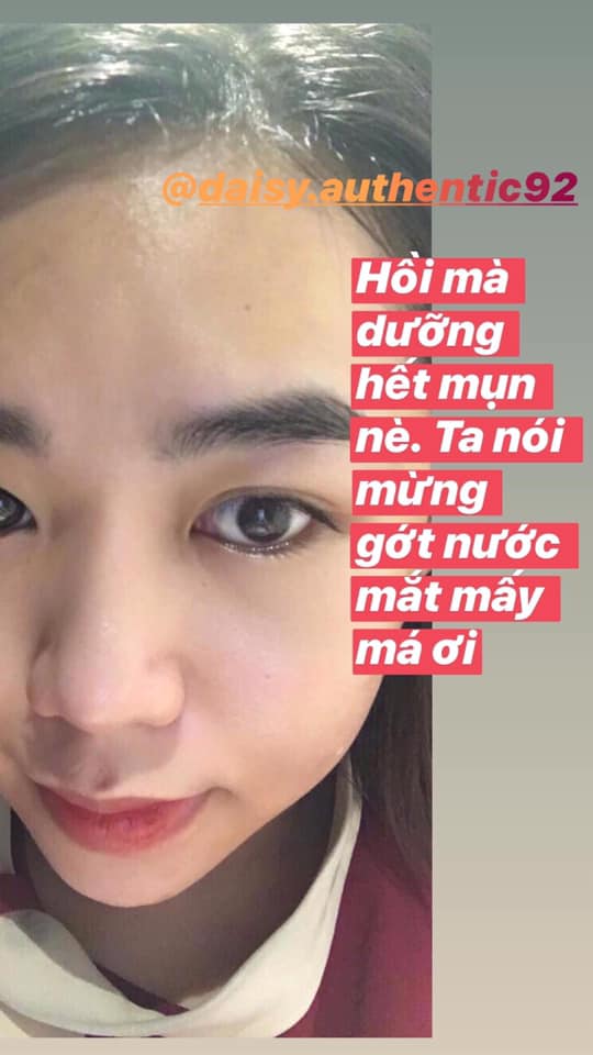 Benzac AC 5% Benzoyl Peroxide 15g - KEM GIẢM MỤN