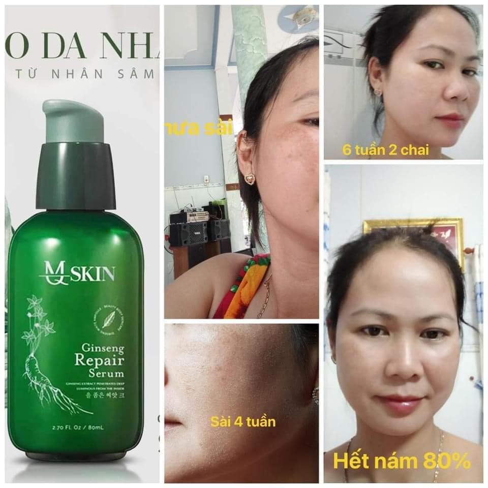 SERUM TÁI TẠO DA NHÂN SÂM MQ SKIN [ xóa mụn nám tàn nhang sẹo rổ ] (80ml)