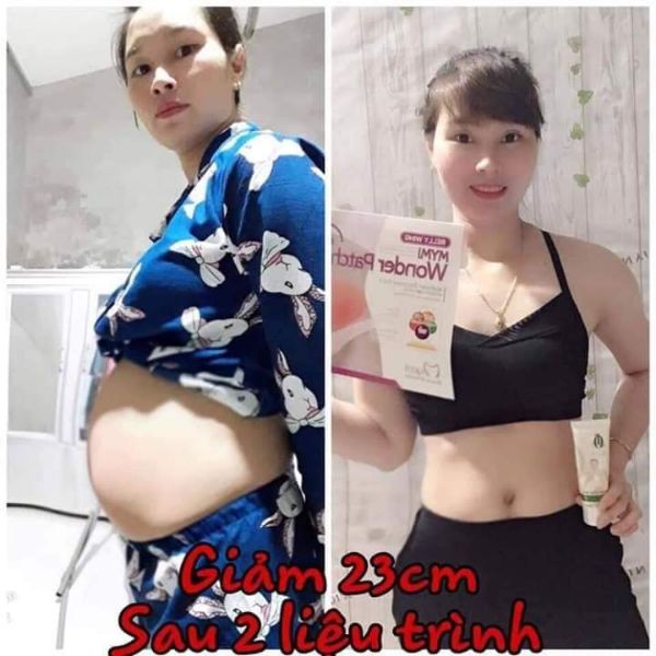 Kem tan mỡ Olic - Tặng 1 miếng dán tan mỡ và thước dây