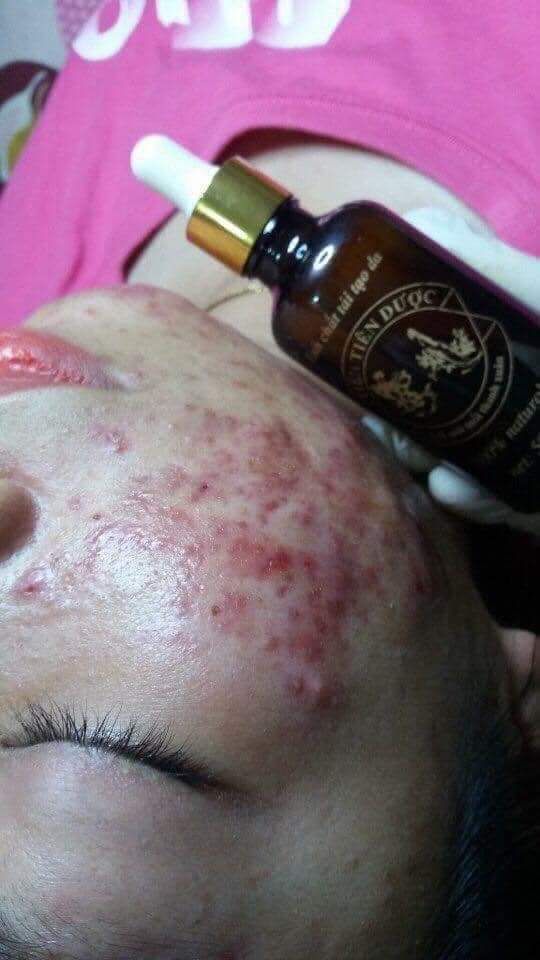tiên tiên dược