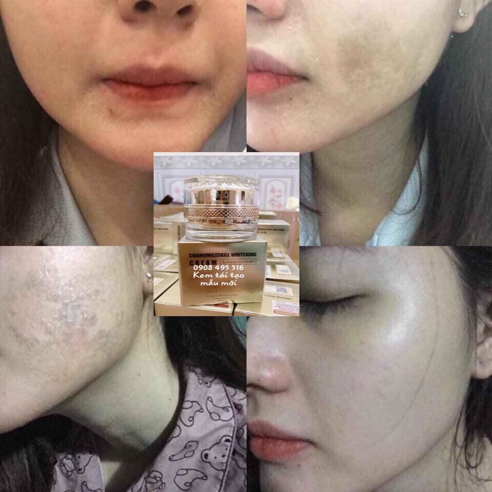 [HCM]COMBO TÁI TẠO và KEM HỒNG SÂM CHAMOMILESKILL
