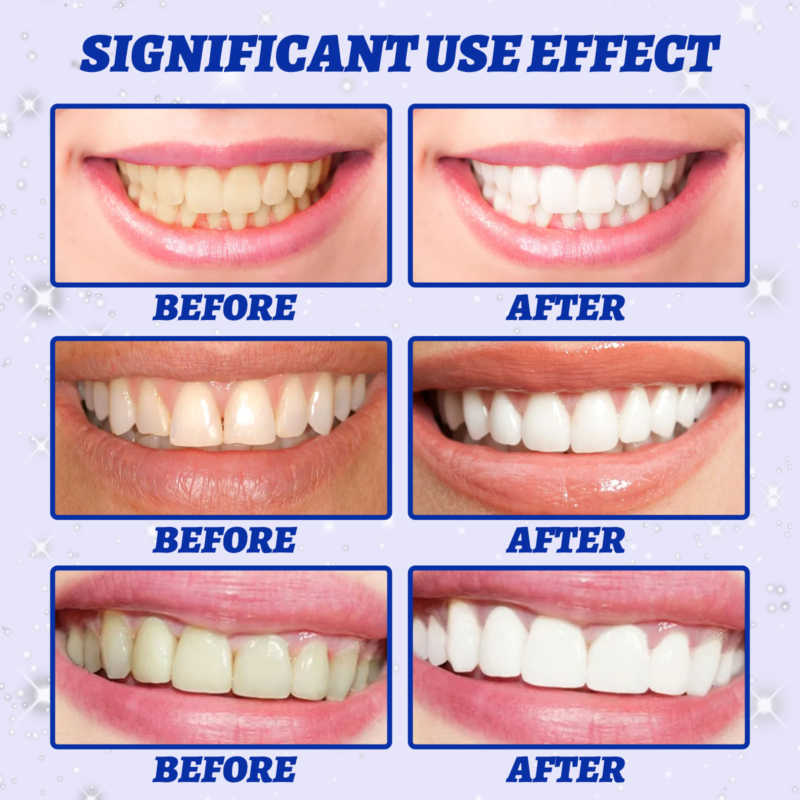 (1 GÓI 7 MIẾNG ) Miếng dán trắng răng chỉ 30 phút 5D TEETH WHITENING STIKER