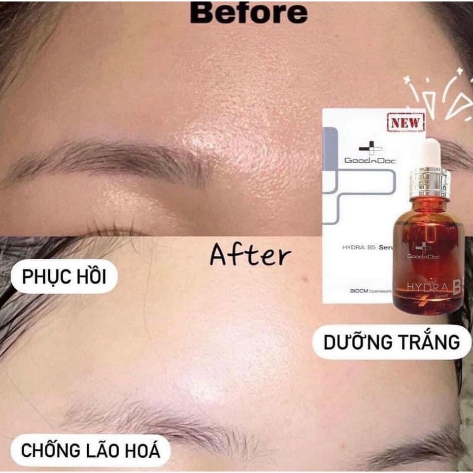 Serum GoodnDoc B5 Hydra Dưỡng Ẩm, Phục Hồi