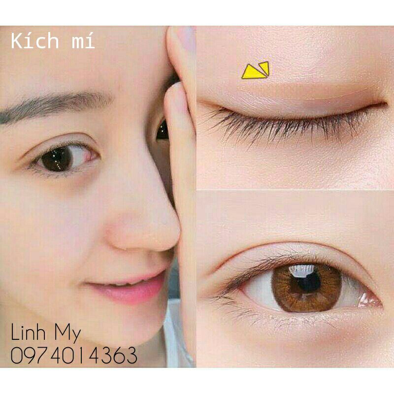 Kích mí lưới không cần keo