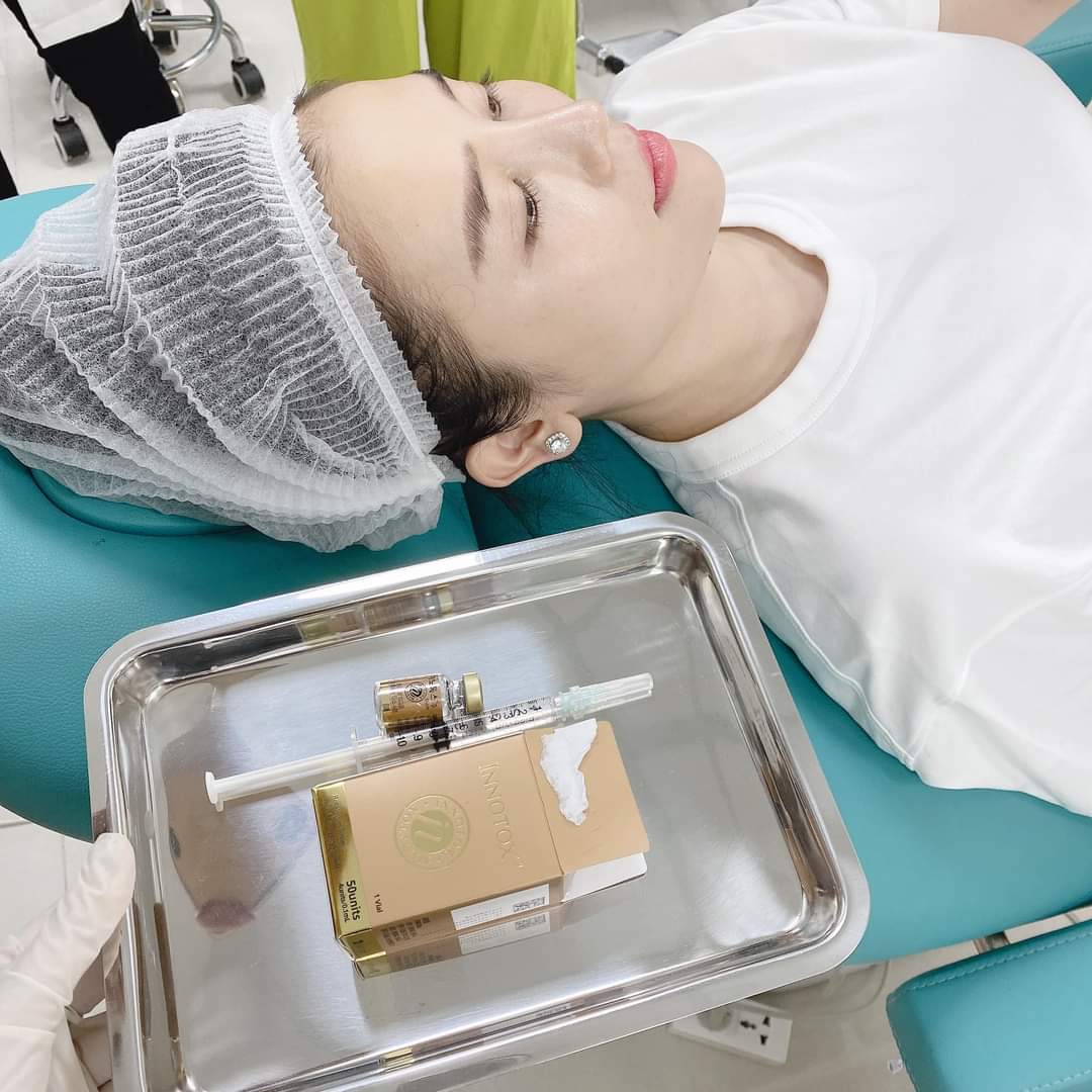BOTOX INNOTOX 50 TIÊM CĂNG TRÁN CỰC ĐẸP ??