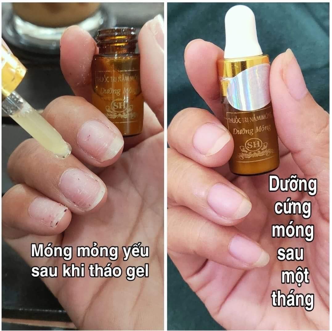 Thuốc Trị Nấm Móng SH