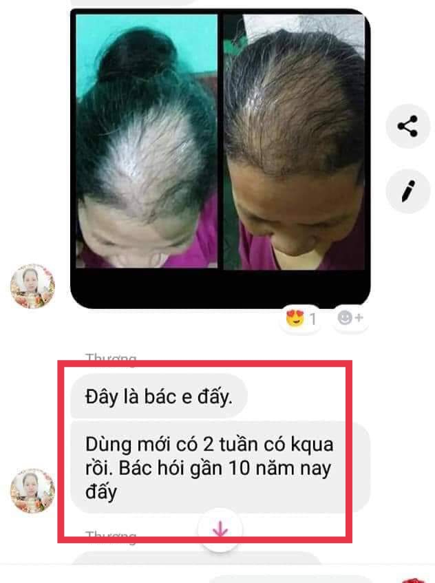 Dầu Gội Laco Thiên Nhiên [chính hãng]