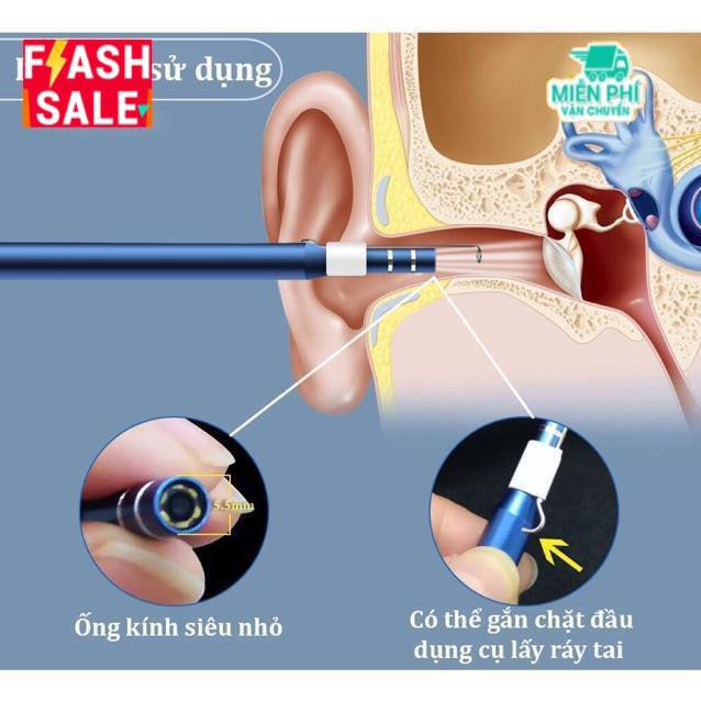 Camera nội soi lấy ráy tai