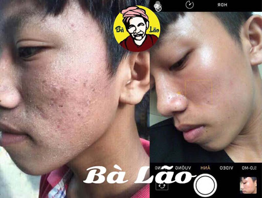 [HCM]Bột rửa mặt BÀ LÃO - ĐInh HƯƠNG (Bán Chạy)