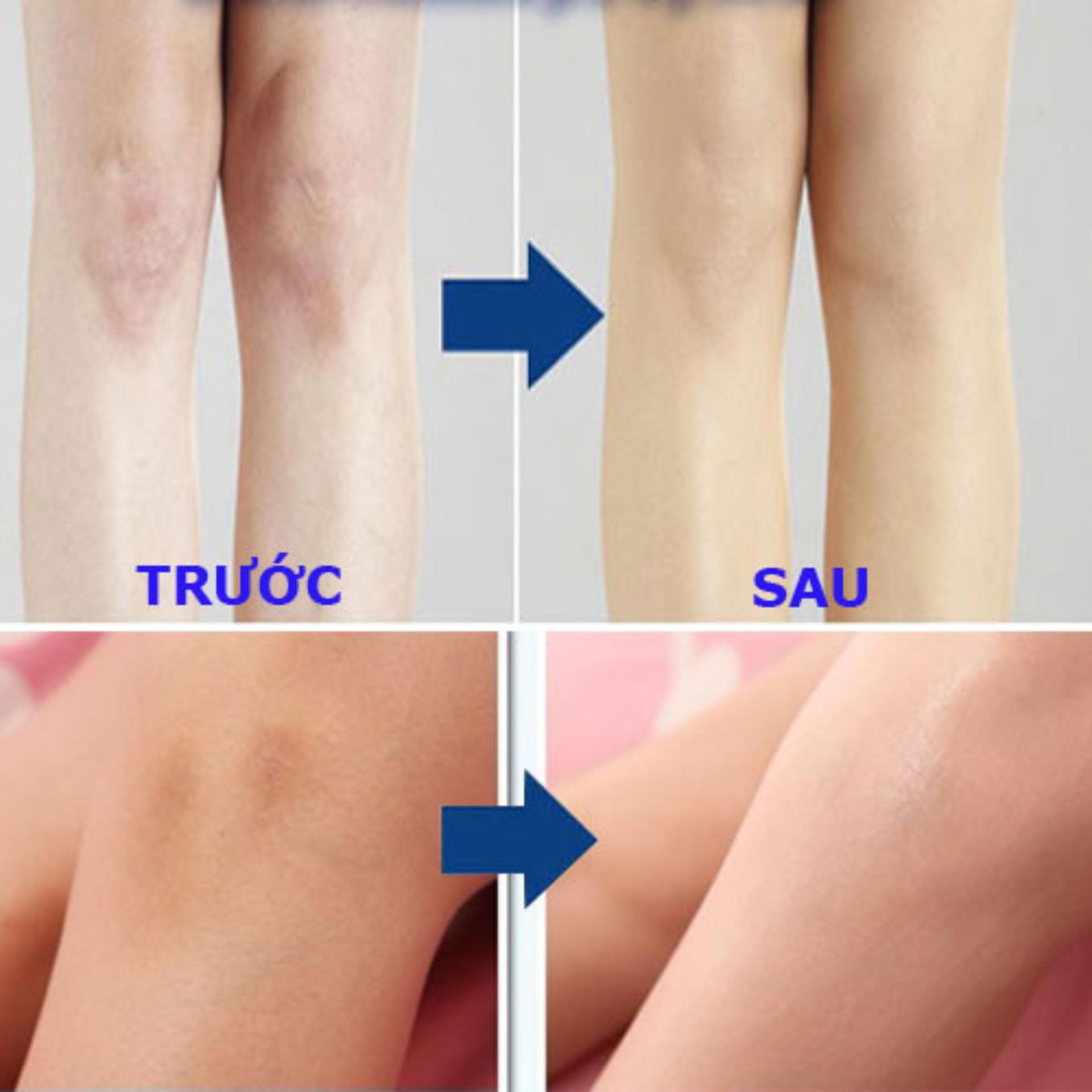 Tất Phun Yufit Airbrush Hàn Quốc (Vớ xịt chân) 100ml (Da tự nhiên trung bình)