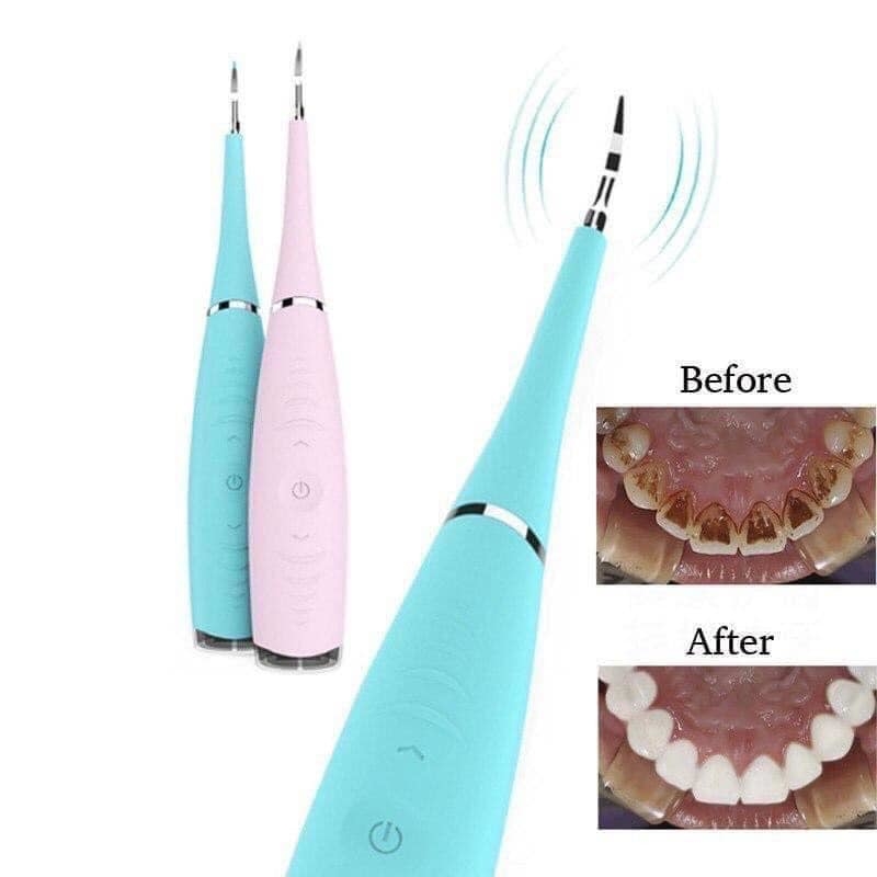 Máy Lấy Cao Răng Cầm Tay Mini Cầm Tay