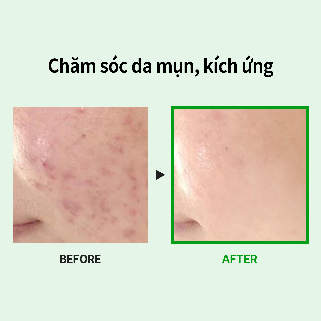 [MEDIPEEL Official]A.C TEA CLEAR