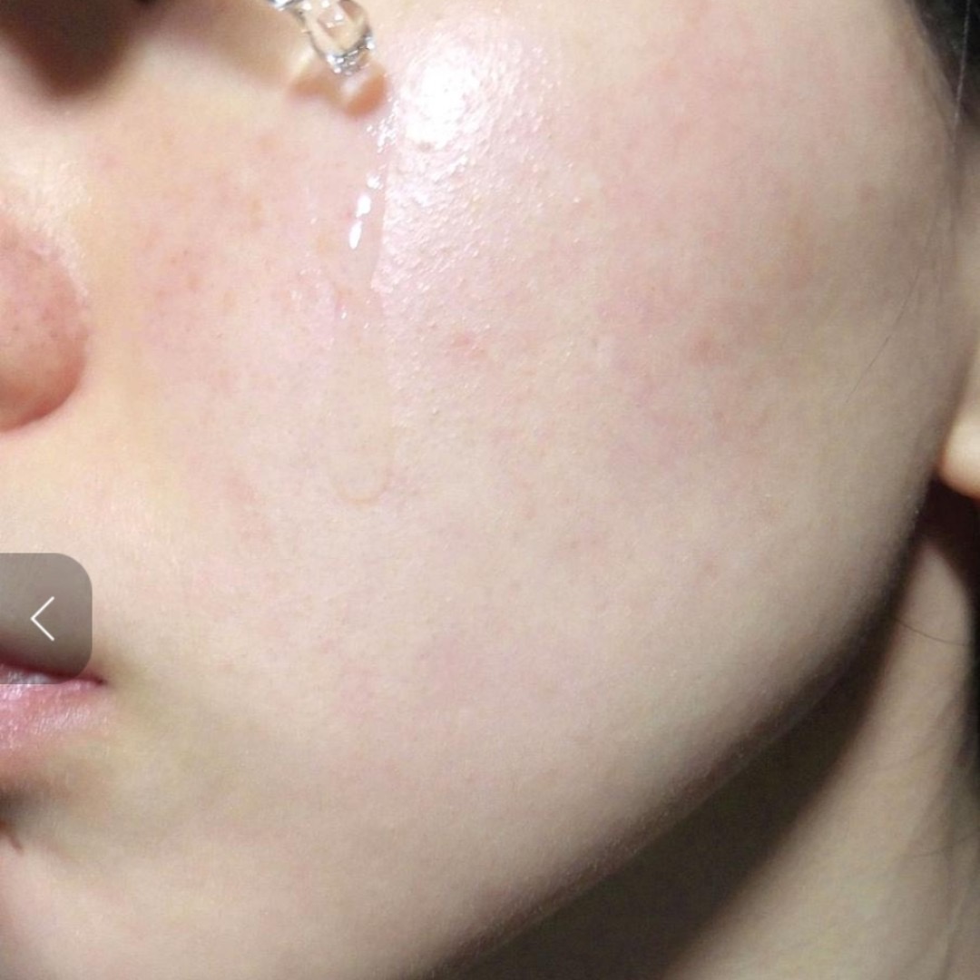 [Nhacuabeautyholic] Dầu dưỡng da Needly Face Light Oil