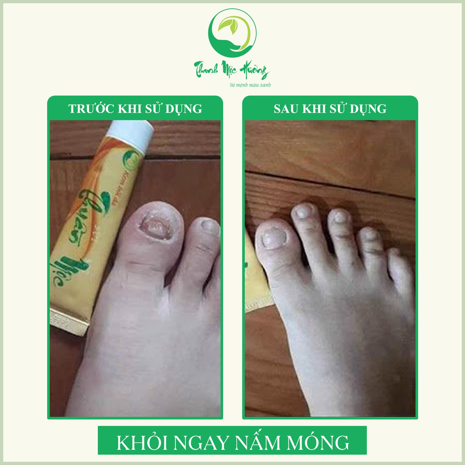 KEM BÔI DA THUẦN MỘC (MẪU MỚI)