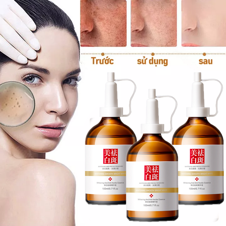 100ml Tinh chất dưỡng trắng serum Xóa nám nhanh chóng Tinh chất dưỡng ẩm dưỡng trắng sáng da loại bỏ nếp nhăn và nám thu nhỏ lỗ chân