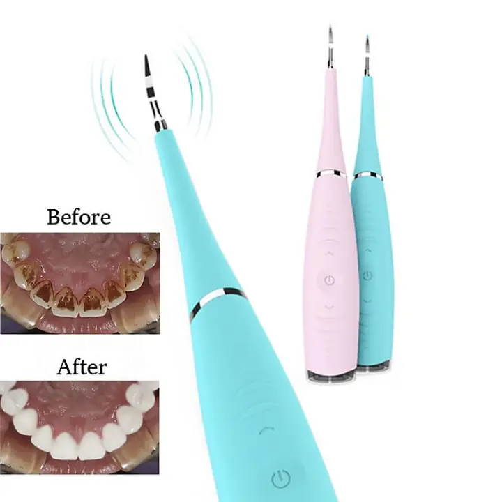 Máy Lấy Cao Răng tại nhà - mini cầm tay - sạc pin 3 chế độ rung - loại bỏ các mảng bám cao răng cứng đầu - hình 14