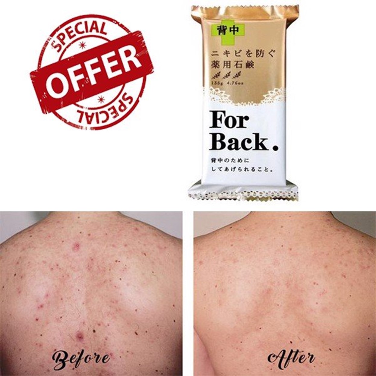 Combo 2 Sản Phẩm Giảm Mụn Lưng Pelican For Back (Xà Phòng Soap 135g + Xịt Body Lotion 100ml)