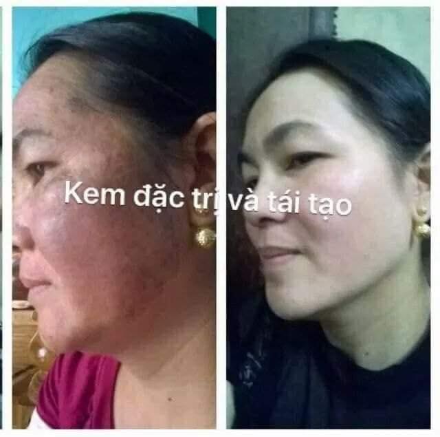 [HCM]Kem tái tạo Chamomileskill