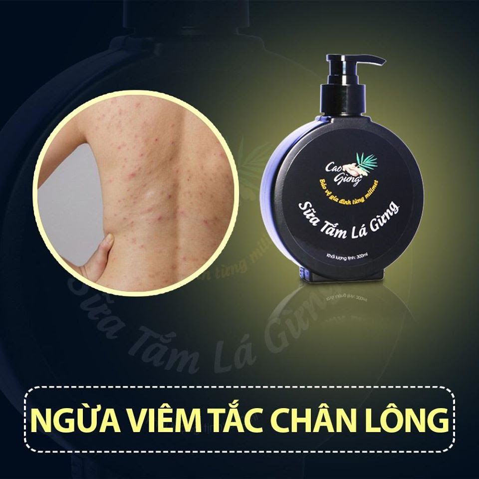 [HCM]sữa tắm lá gừng 300 ml