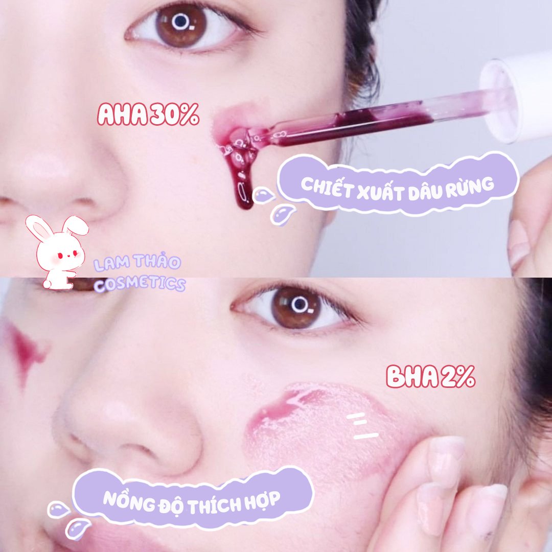 Thay Da Sinh Học SoNatural Red Peel Tingle Serum