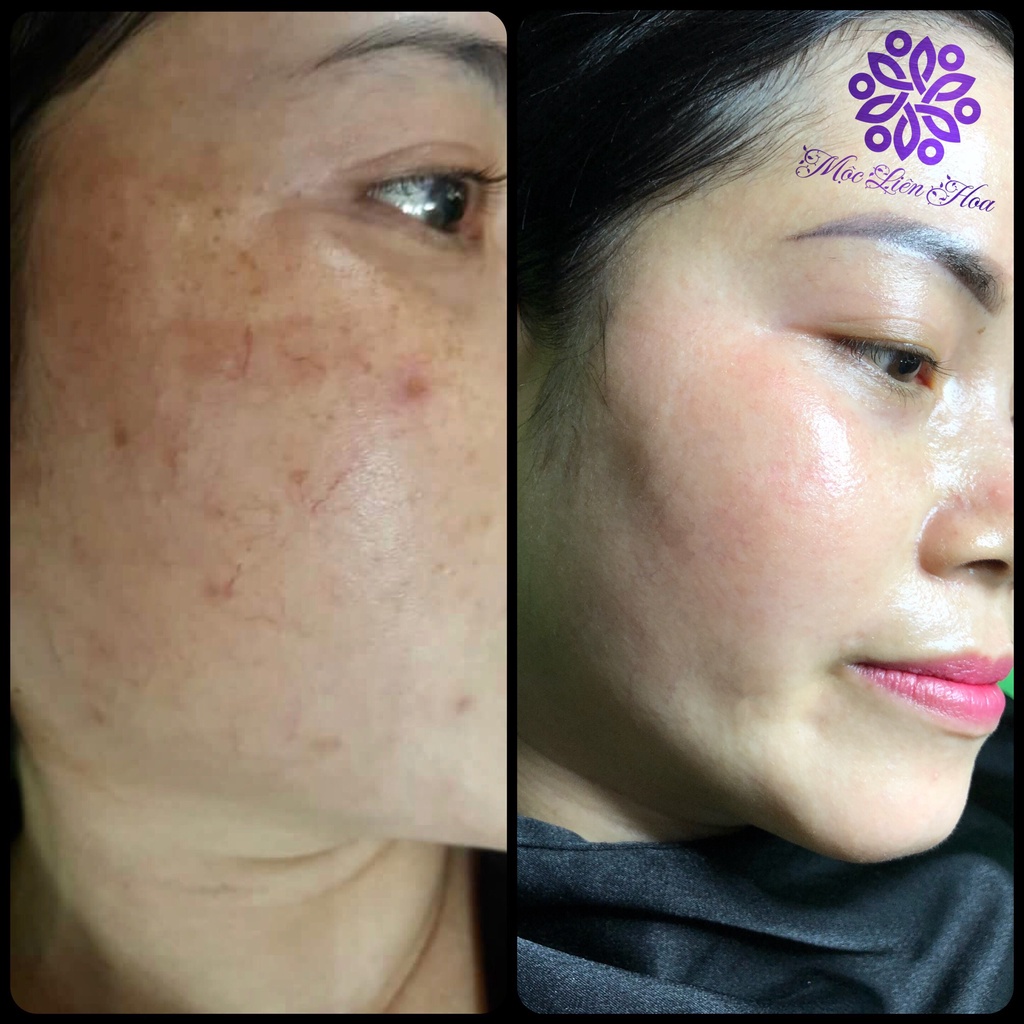 Tailor Made K ULTRA SPOT Kem Quế Hoa (mẫu mới)