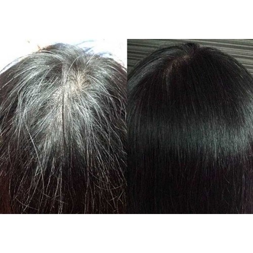 2KG (4 hộp) Viên Hà Thủ Ô làm đen râu tóc