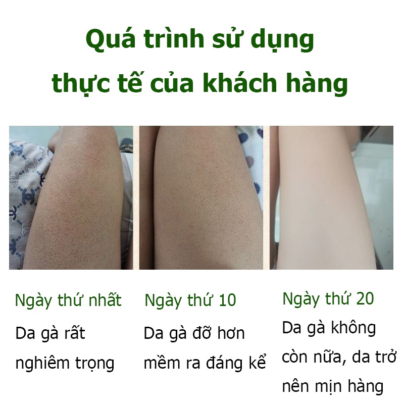 kem tẩy tế bào chết tẩy tế bào chết body 250g body toàn thân tắm trắng toàn thân kem body trắng làm trắng dưỡng thu nhỏ lỗ chân lông Dưỡng ẩm và cấp nước cho da