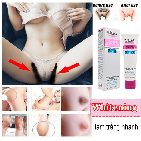 Kem dưỡng trắng da body giảm thâm nách khử mùi hôi nách làm trắng da body cấp ẩm Whitening Underarming Moisturizing Body Lotion Cream