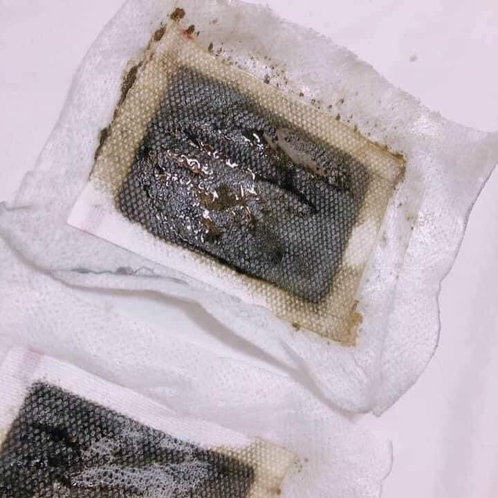 💯💯[HÀNG CHÍNH HÃNG THÁI LAN] MIẾNG DÁN CHÂN THẢI ĐỘC LANNA FOOT PATCH 💯💯